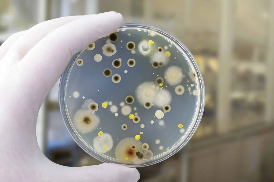 How to Remove Mold from Leather 5 Is Mold Testing Necessary For Your Home? How To Test For Black Mold At Home