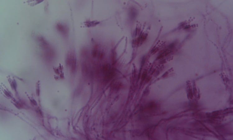 penicillium mold